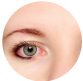 Can lenses scratch my eye?